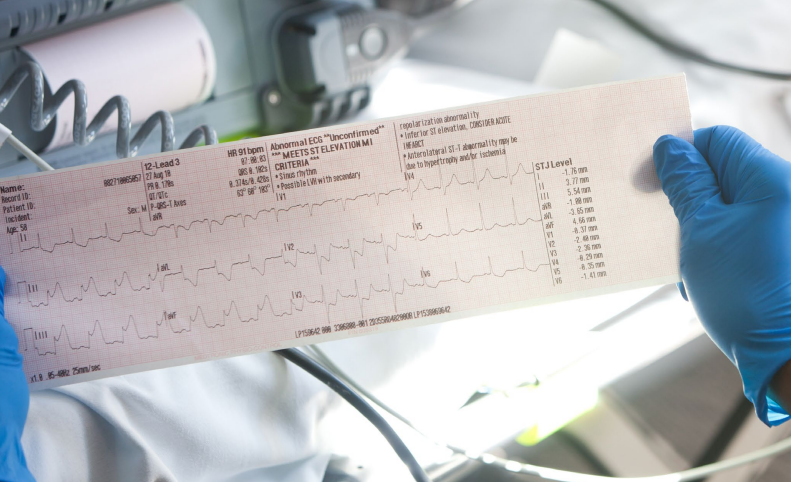 STEMI reading