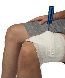 DO NOT remove the foreign object, but apply padding on either side.